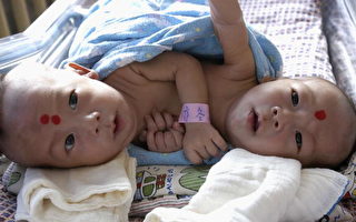 安徽連體嬰兒上海作手術