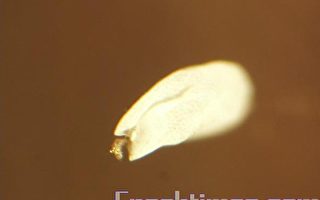 优昙婆罗花显微镜放大照片 花蕊清晰可见