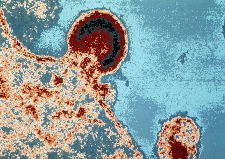 法国巴斯德研究所的显微镜照片显示了HIV病毒如何入侵人体淋巴细胞。(Getty Images)