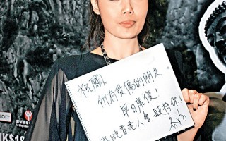 Selina拍戲受灼傷 香港藝人祈禱挺過難關