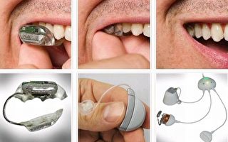 新發明：齒式助聽器 通過牙齒傳送聲音