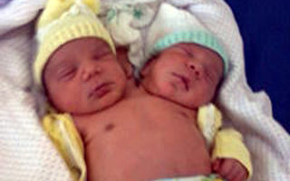 巴西婦 產罕見雙頭連體男嬰