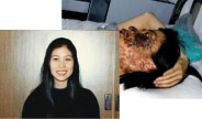 高蓉蓉,原辽宁省沈阳鲁迅美术学院财务处职工。2004年5月7日,遭龙山教养院二大队副大队长唐玉宝、队长姜兆华连续6小时的电击,被严重毁容,后来高蓉蓉因感染死亡。(明慧网) 高蓉蓉,原辽宁省沈阳鲁迅美术学院财务处职工。2004年5月7日,遭龙山教养院二大队副大队长唐玉宝、队长姜兆华连续6小时的电击,被严重毁容,后来高蓉蓉因感染死亡。(明慧网)