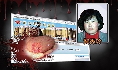 贺秀玲因修炼法轮功遭到当局迫害非法关押,被看守所以“脑膜炎”名义送医院,在人还有呼吸的情况下就被送进太平间,家属发现其后腰部缠绕绷带,肾脏被盗。(图片合成/大纪元) 贺秀玲因修炼法轮功遭到当局迫害非法关押,被看守所以“脑膜炎”名义送医院,在人还有呼吸的情况下就被送进太平间,家属发现其后腰部缠绕绷带,肾脏被盗。(图片合成/大纪元)
