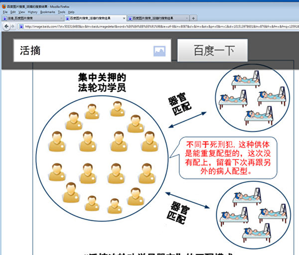 百度上搜索出现大量中共活摘法轮功学员器官真相图片。(网路截图) 百度上搜索出现大量中共活摘法轮功学员器官真相图片。(网路截图)