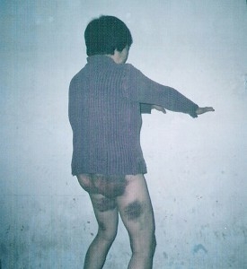 法輪功女學員劉季芝遭河北公安毒打並姦污,臀部、腿部多處外傷 。(明慧網) 法輪功女學員劉季芝遭河北公安毒打並姦污,臀部、腿部多處外傷 。(明慧網)