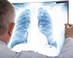 全球空气恶化  专家教你养出干净的肺