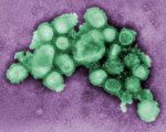 疾病控制与预防中心透过显微镜拍摄的猪流感病毒H1N1病毒株。 （AFP）