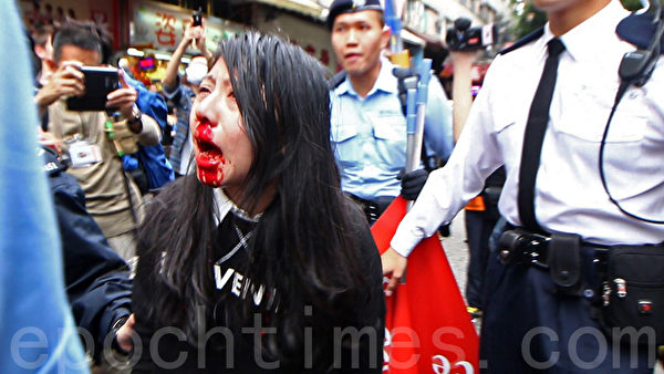 靠近元朗大桥街市,有一名长发女示威者口鼻流血受伤,由女警带走。(蔡雯文/大纪元) 靠近元朗大桥街市,有一名长发女示威者口鼻流血受伤,由女警带走。(蔡雯文/大纪元)