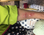 两名陆客台湾夜市玩空拍机 砸伤议员母亲