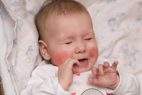 父母應預防寶寶被電燒傷擊傷。(Shutterstock)