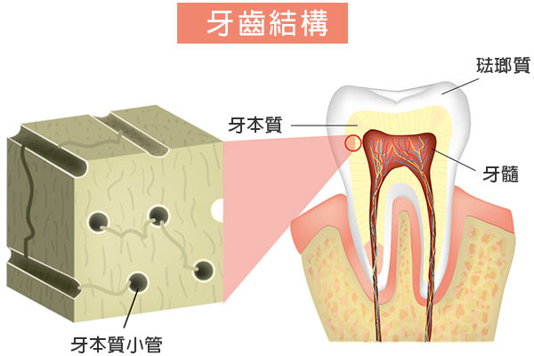 牙本质是构成牙齿主体的微黄色组织，位于牙齿表层的珐琅质下面。(Shutterstock)