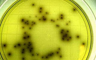 研究人員發現治療李斯特菌新方法
