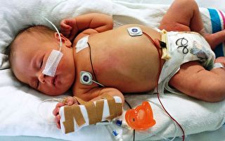 新生兒心臟在胸外跳動 生命力旺盛的她 能活下來嗎？