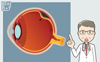 視網膜剝離：若不注意5個徵兆 可致失明