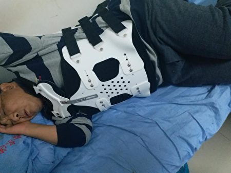 龐姓哈爾濱律師於2017年12月遭前房主等人暴打，傷至兩根肋骨、三根腰椎骨骨折，腰部需用鐵夾板固定。（受害人提供）