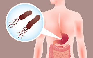 幽門螺旋桿菌和胃癌有關 3招揪出感染防癌