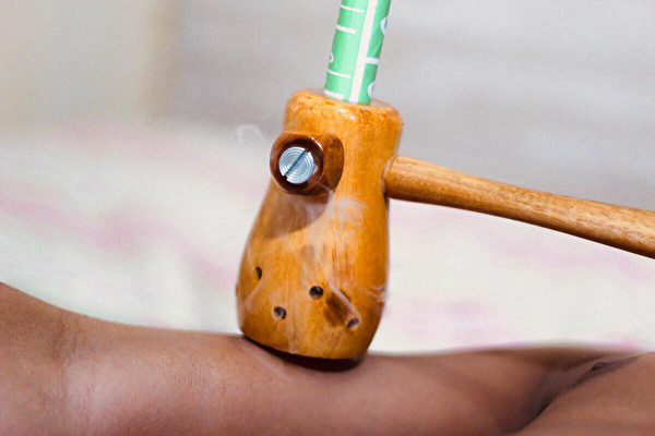 将点燃艾条插入木制葫芦艾灸器内，对着穴位或疼痛处施灸。(Shutterstock)