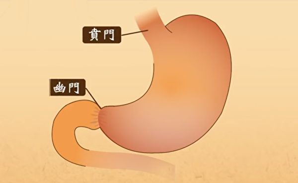 當賁門因某些原因開始鬆弛或關不住時，就會形成胃食道逆流。（談古論今話中醫提供）