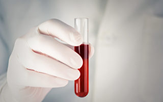急性骨髓性白血病是最常見的成人急性白血病，有哪些症狀？(Shutterstock)
