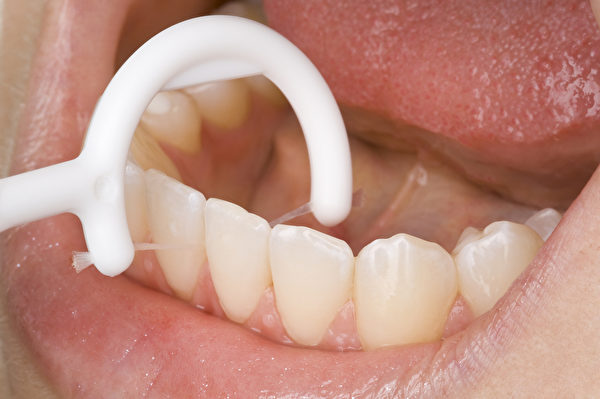 刷牙往往只能清潔到牙齒表面，牙齒之間的接面與縫隙初步要靠牙線來處理。(Shutterstock)