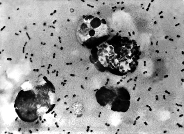 鼠疫是由鼠疫桿菌（yersinia pestis）引起，老鼠等齧齒動物能夠攜帶病菌，並通過跳蚤傳播。(Shutterstock)