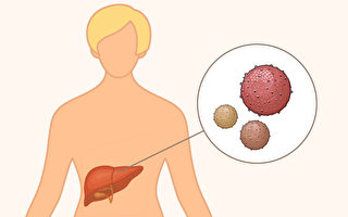 3种肝炎可成肝癌推手！关于肝炎你要知道的事