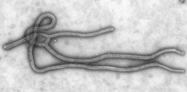 致死率可達到90%的、高度致命的伊波拉病毒Ebola Virus。(Wikimedia Commons)