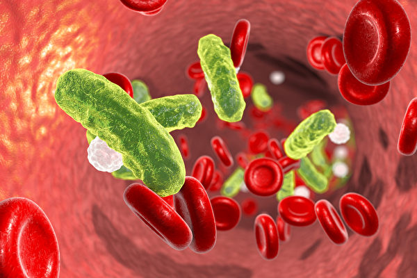 当人体免疫力不足时，受到中共病毒的感染，可能会引起全身性的发炎反应，导致败血症，甚至出现多重器官衰竭。(Shutterstock)