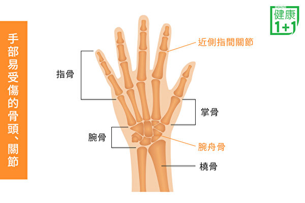 手部容易受傷的骨頭和關節，包括指骨、掌骨。（健康1+1／大紀元）