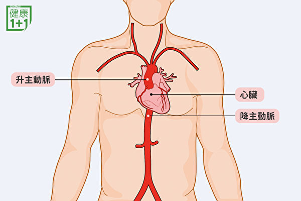 發生在升主動脈的主動脈剝離非常嚴重，可能引起心肌梗塞。（健康1+1／大紀元）