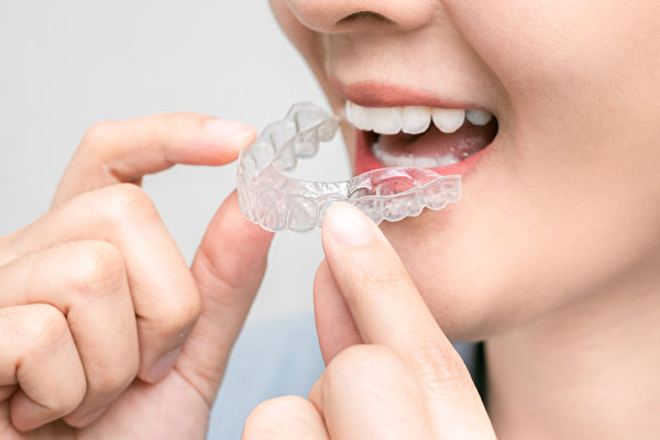 “隐形牙套”是以高分子材料制成，整副牙套是透明的，不影响美观。(Shutterstock)