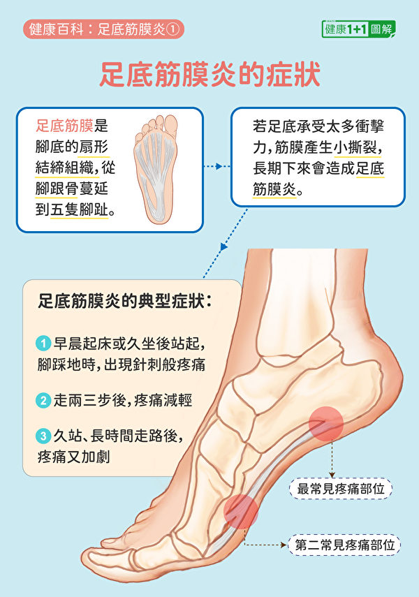 足底筋膜炎症狀，最常見的是腳跟痛。（健康1+1／大紀元）