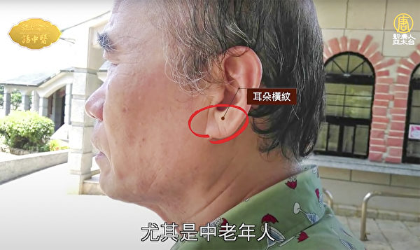 有些中老年人的耳垂出現一條紋，這條紋叫「冠心溝」，這有可能是高血壓問題。（談古論今話中醫提供）