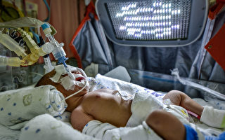 英國醫院新呼吸療法挽救一個嬰兒的生命