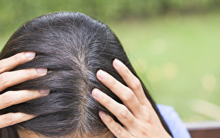長白髮可能是身體警訊 10種原因一定要當心