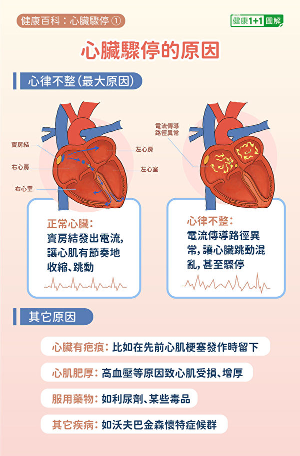 心脏骤停原因主要是心律不整，其它还包括曾经有心肌梗塞、心肌肥厚等。（健康1+1／大纪元）