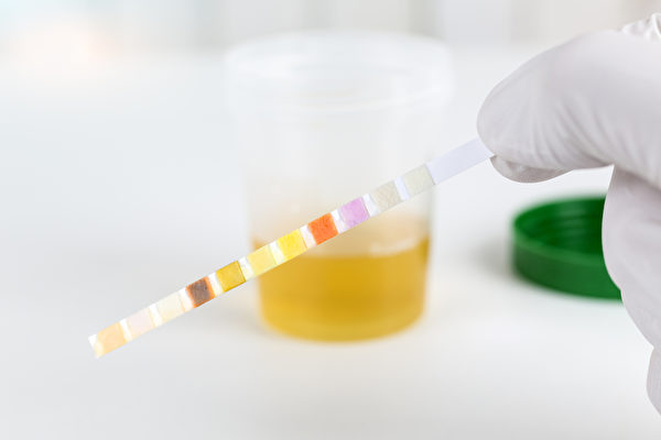 將試紙浸入尿液中來觀察試紙顏色的變化，也可稱之為試紙檢查法。(Shutterstock)