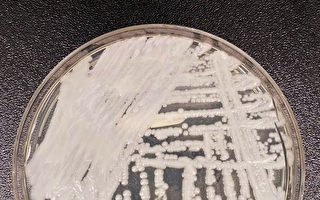 美CDC警告：可致命的耳念珠菌病例激增