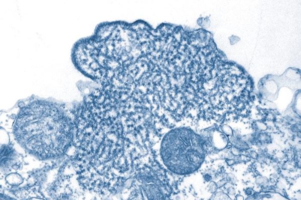 新冠肺炎疫情未趋缓，专家示警立百病毒具有造成下一波大流行的风险。（维基百科公有领域）