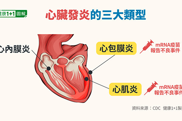 心臟發炎分為心肌炎、心包炎和心臟外膜炎，接種mRNA疫苗後出現的是前兩種。（健康1+1／大紀元）