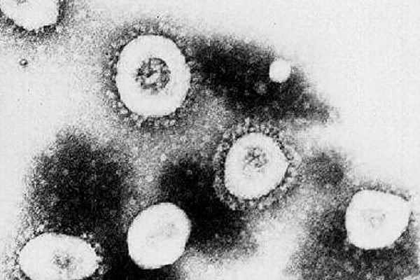 關於新冠病毒來源，目前有兩種認可度較高的推測：自然來源和實驗室。 (CDC/Getty Images)