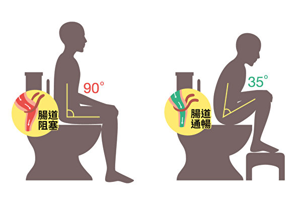 正確的上廁所姿勢可以促進排便。（Shutterstock／大紀元製圖）