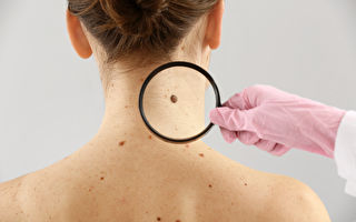 研究：安省皮肤癌患病率上升30%