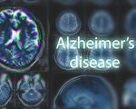 研究发现导致阿兹海默症的深层原因