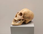 2000年前先進技術 祕魯頭骨嵌入不明金屬