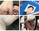 上海女子做核酸咽喉受伤 外出寻医遭警殴打