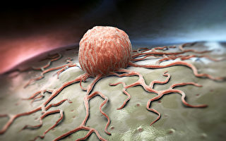 癌细胞对糖如饥似渴，怎样有效把癌细胞“饿死”？(Shutterstock)