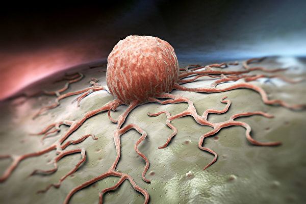 癌细胞对糖如饥似渴，怎样有效把癌细胞“饿死”？(Shutterstock)