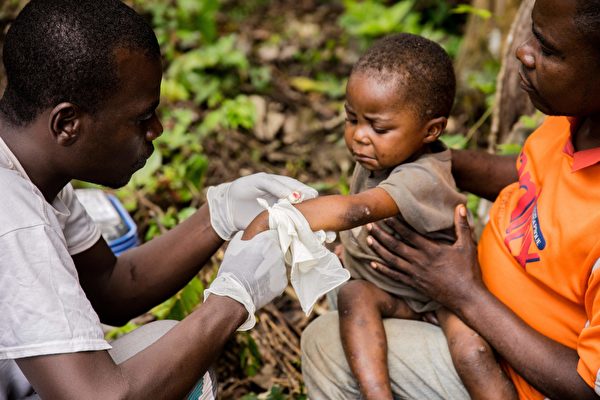 非洲之外近三百人確診猴痘 分布在哪些國家